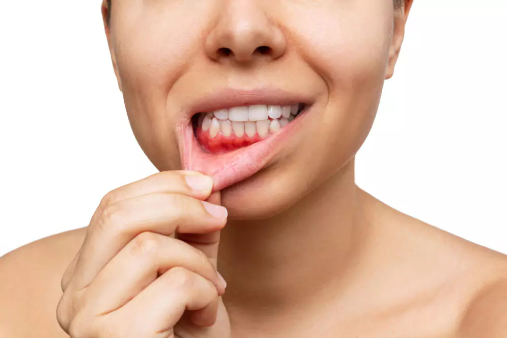 Gum Disease Management