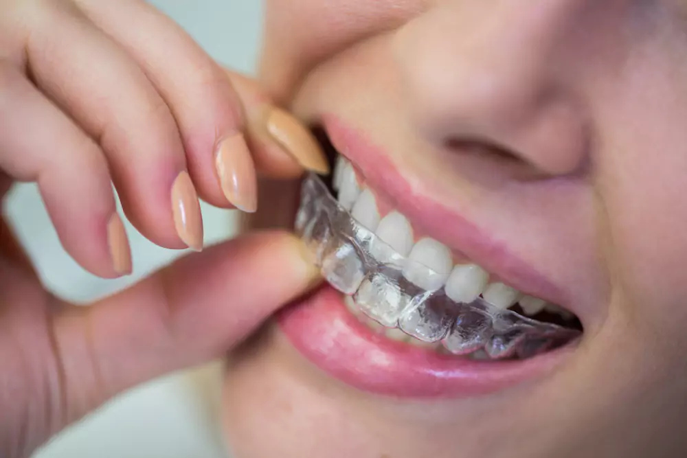 Braces & Invisalign